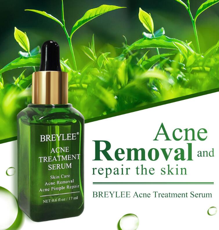 Acne Treatment
