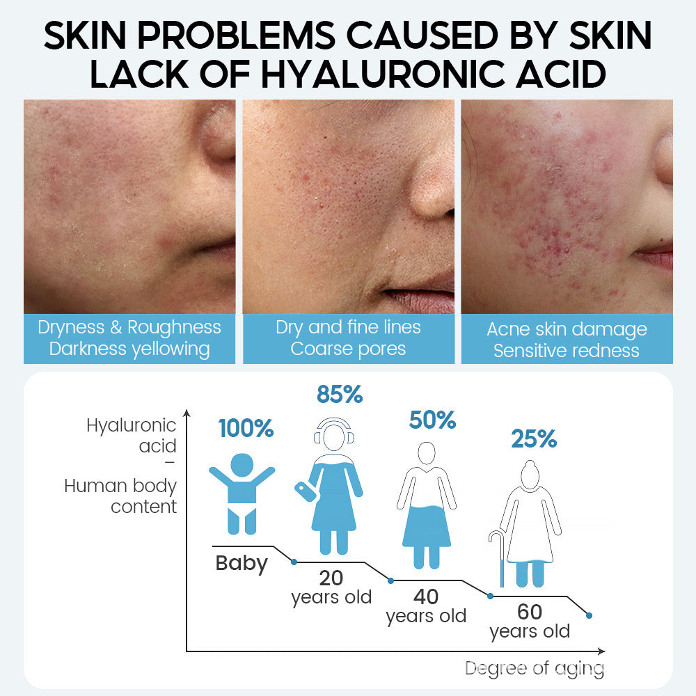 Hyaluronic Acid