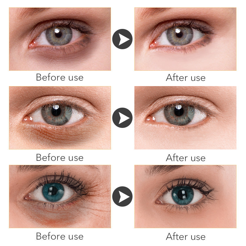 Beauty Eye