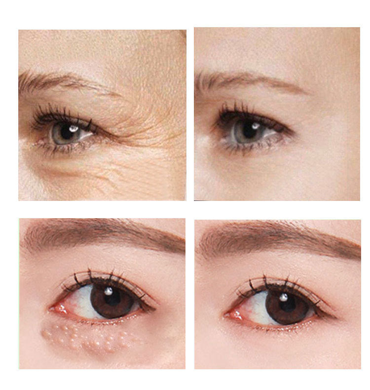 Beauty Eye