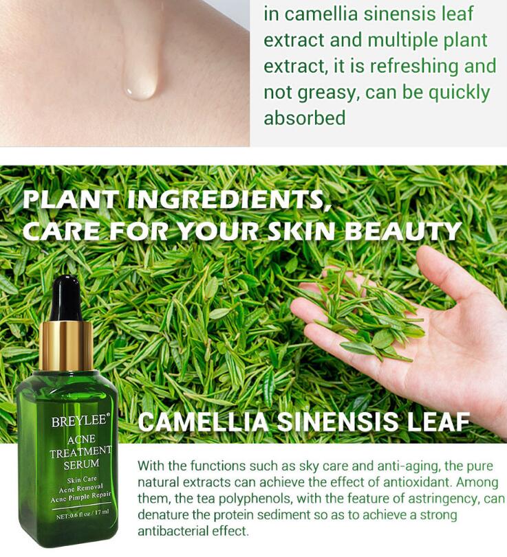 Acne Treatment
