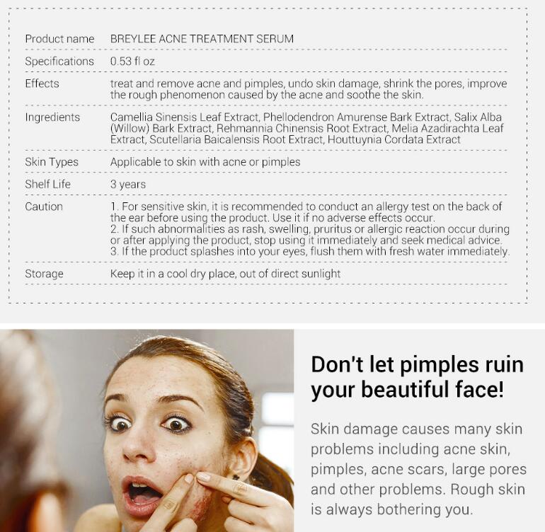 Acne Treatment