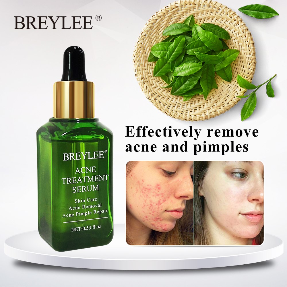 BREYLEE Acne