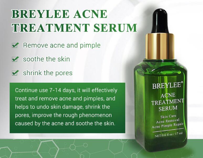 Acne Treatment