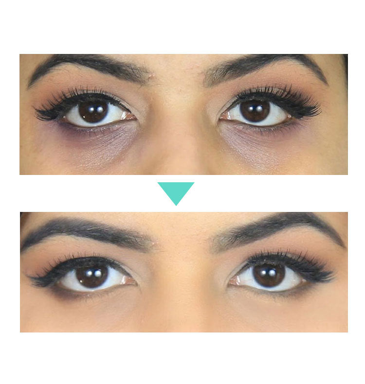 Beauty Eye 
