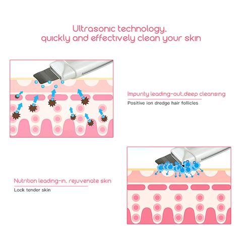 Ultrasonic Skin 