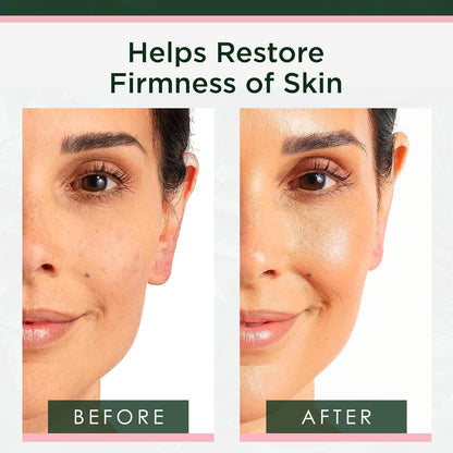 PDRN Serum for Face with Salmon DNA & CICA, 1 Fl Oz | Firming PDRN Serum with Salmon DNA and CICA. Hydrating Face Oil Targets Dark Spots and Fine Lines for Clear Skin.